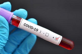 Jak stát podporuje zaměstnance v době karantény COVID-19